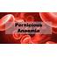 Pernicious Anemia  Causes Signs Symptoms Treatment