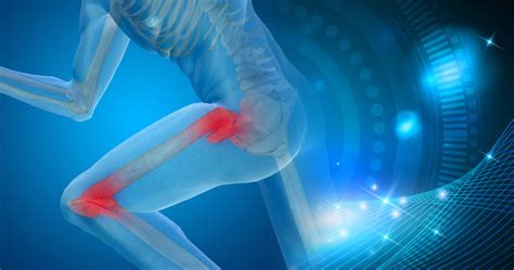 Regenerative Treatment Options For Arthritis Of The Hip And Knee