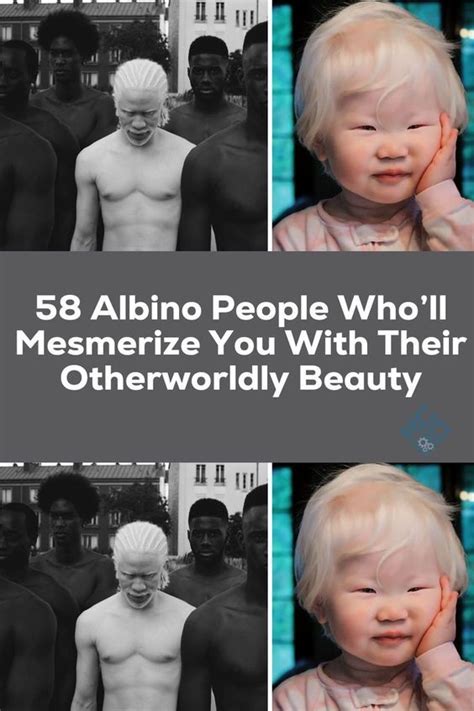 Three Different Pictures With The Words Albino People Who Ll Mesmerize You With Their