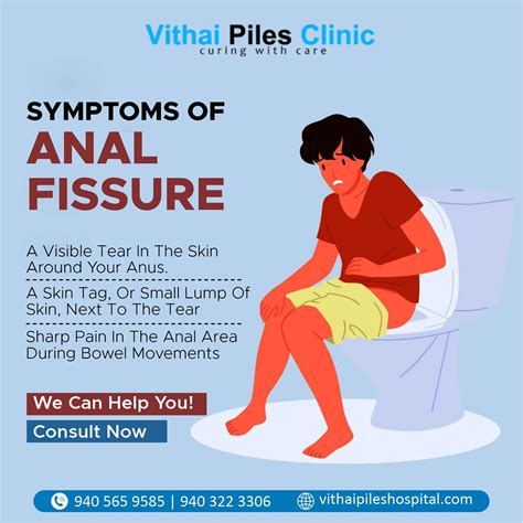 Symptoms Of Anal Fissure Vithai Piles Hospital In Pcmc Flickr