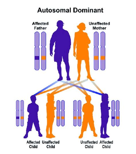 Schematic View Of The Dominant Autosomal Inheritance Pattern That