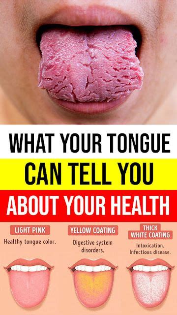 2 What Your Tongue Can Tell You About Your Health Medicaldaily