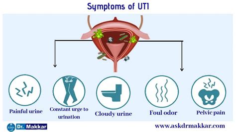 Urinary Tract Infection Uti Treatment Using Homeopathy With Excellent