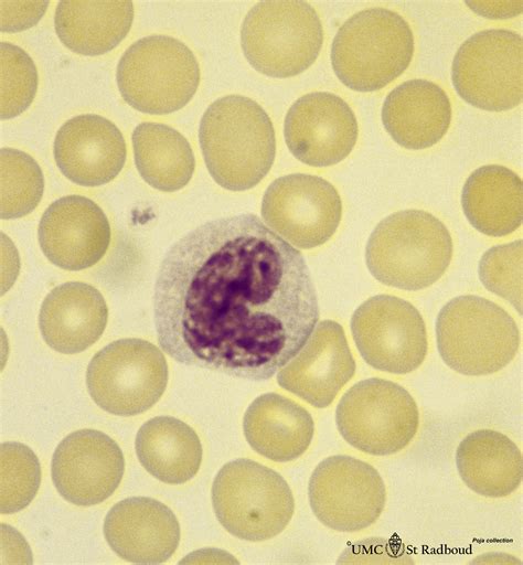 Monocyte In Peripheral Blood Smear Human Eccles Health Sciences