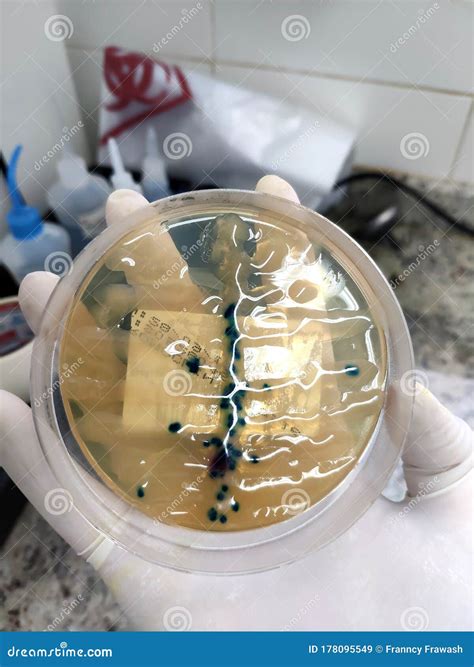 Pseudomonas Aeruginosa Urine Culture On Chromogenic Agar Stock Image