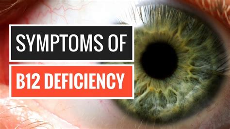 5 Signs And Symptoms Of Vitamin B12 Deficiency Youtube