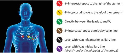 The reason being that any misplacement of the ecg leads may lead to a misdiagnosis or further, unnecessary investigations and treatments. Correct 12 lead ECG placement | Research | ADInstruments