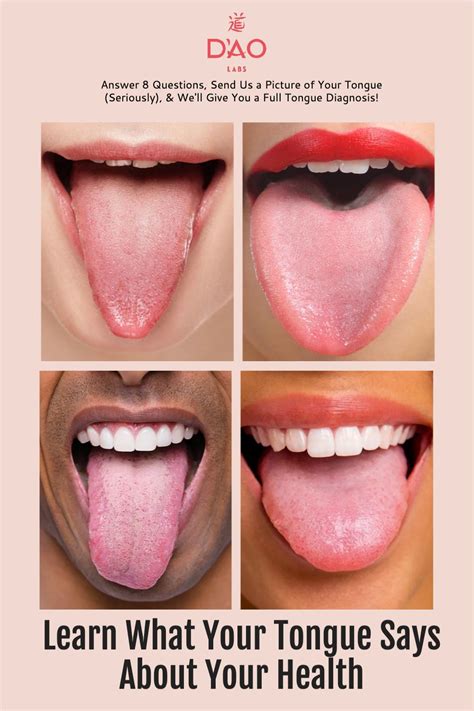Free Traditional Chinese Medicine Tongue Diagnosis Healthy Tongue