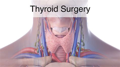Thyroid Surgery Thyroidectomy Otolaryngology Specialists Of North Texas