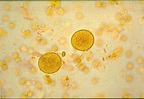 Entamoeba coli Cysts in feces | Medical Laboratories