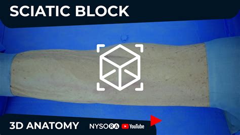 New Video Sciatic Block Anatomy Explained Nysoras 3d Anatomy Videos