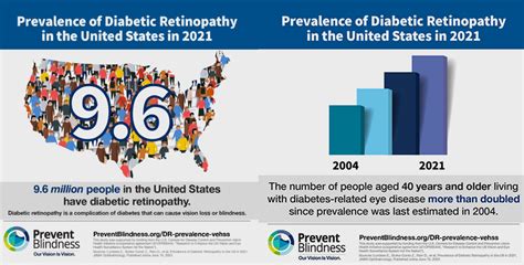 Study Finds Significantly More Adults Living With Diabetic Retinopathy In The United States Than