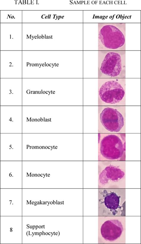 Table I From Classification Of Cell Types In Acute Myeloid Leukemia