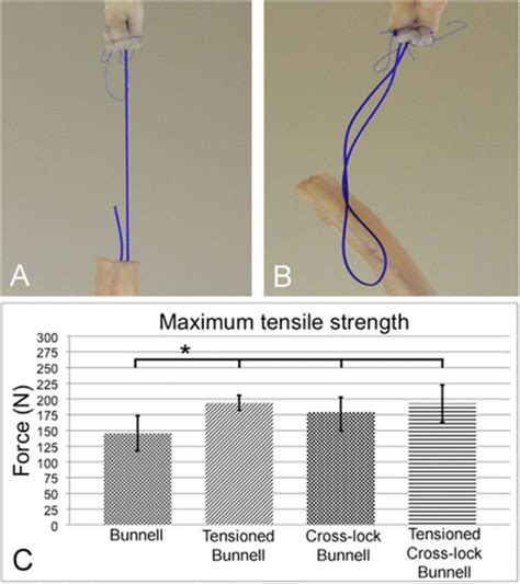 Maximum Tensile Strength A Failure By Suture Rupture B Failure By Download Scientific Diagram