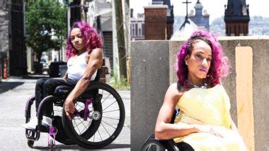 Woman With Spina Bifida Catwalks Like A Dream While Sending Across A