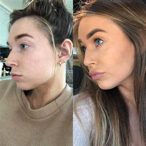 Before And After Make Up Wanting A Nose Bridge Filler To Fill In My
