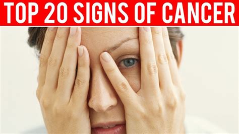 20 Early Warning Signs Of Cancer You Dont Want To Ignore Youtube