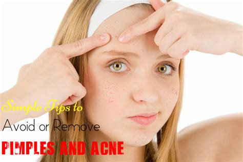 Simple Tips To Avoid Or Remove Pimples And Acne Stylish Walks