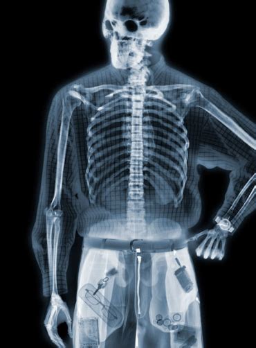 Ultimate Examples Of X Ray Photography By Nick Veasey Spicx