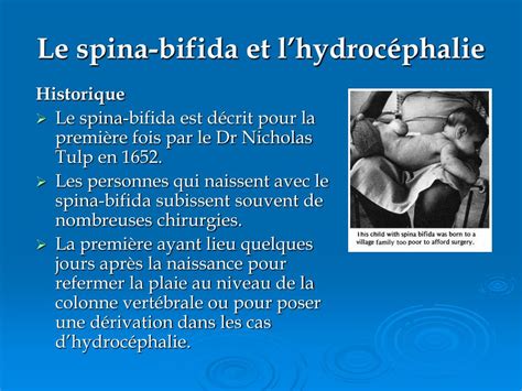 Ppt Campagne De VisibilitÉ Du Spina Bifida 2008 Powerpoint