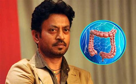 Irrfan Khan Passes Away Due To Colon Infection What Is Colon Infection