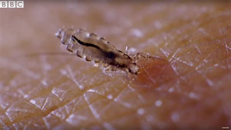 Presenter Gives Himself Head Lice On Purpose Earth Science Youtube