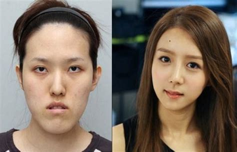 直击：10位韩国女性整容前后的对比照，丑女瞬间变成大美女