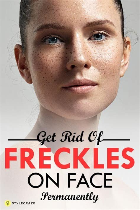 12 Home Remedies To Get Rid Of Freckle On Face Getting Rid Of