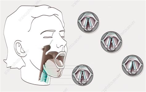 Vocal Cord Illustration Stock Image C0354642 Science Photo Library
