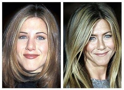 Jennifer Aniston Plastic Surgery Nose Job Before And After Botox Injection Celebrity Before