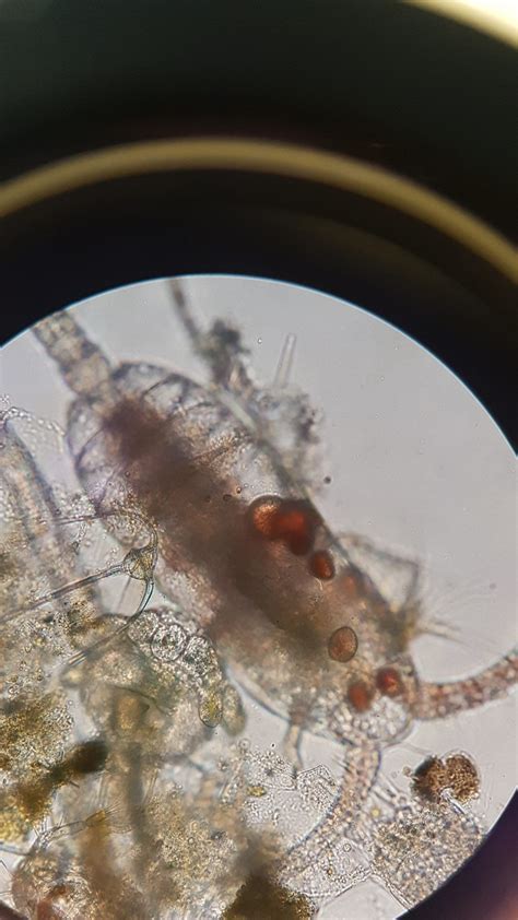 Under Microscope Copepod With Parasites Brittany Ferries