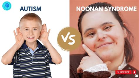 What Is The Link Between Autism And Noonan Syndrome Asd And Noonan Syndrome Youtube