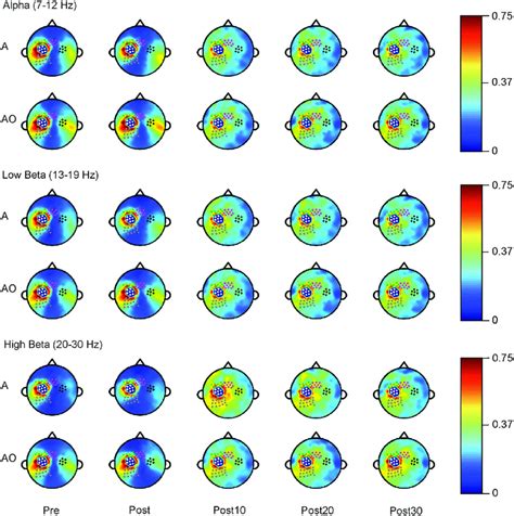 Eeg Coherence Prepost Priming Aerobic Exercise A And Action