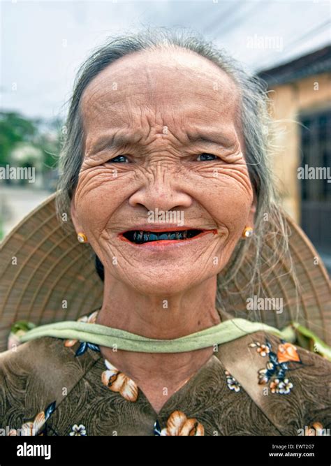 Betel Nut Teeth Hi Res Stock Photography And Images Alamy