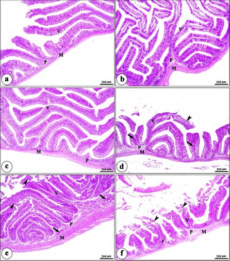 Histomicrography Of Intestinal Tract Of Nile Tilapia Of Different