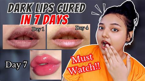 How To Achieve Soft Pink Plump Lips Lip Serum To Lighten Dark Lips