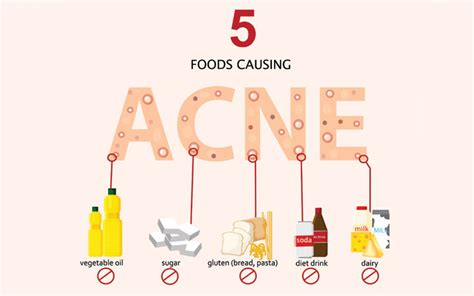 Acne Diet 9 Foods That Cause Pimplesplus Foods That Clear Them