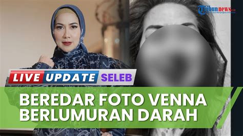 Polisi Ungkap Kronologi Ibunda Verrel Bramasta Alami Kdrt Foto Venna