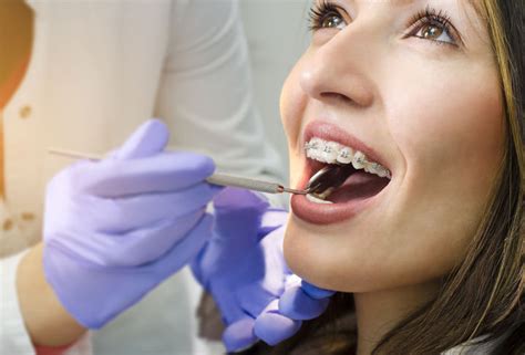 Ortodoncia Digital Con Brackets Chapela Dental