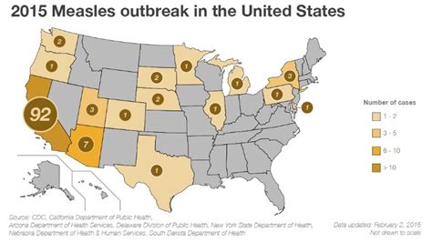 2015 Measles Outbreak What To Know Cnn
