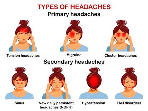 tipos de dolores de cabeza vector infografía vector premium