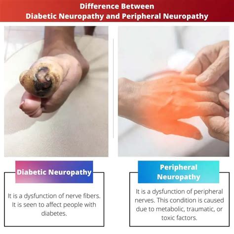 Diabetic Vs Peripheral Neuropathy Difference And Comparison