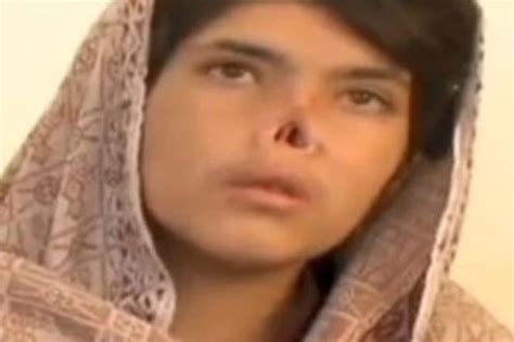 Woman Mutilated By Taliban Husband Flies To Us For Surgery London