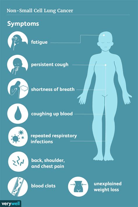 Lung Cancer Symptoms And Signs