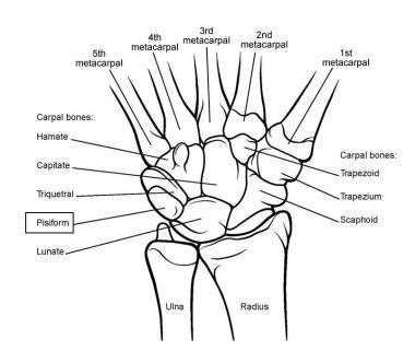 The radius bone is this bone here and it lies laterally in the anatomical position. Carpal Bones