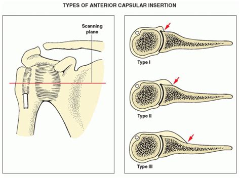 Upper Limb I Shoulder Girdle Radiology Key