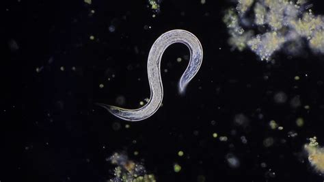 Microscopic Worms Nemotodes Youtube