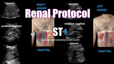 Renal Ultrasound Protocol Youtube