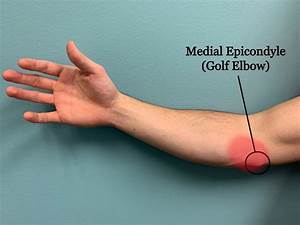 Elbow Injury 2 Capital Chiropractic