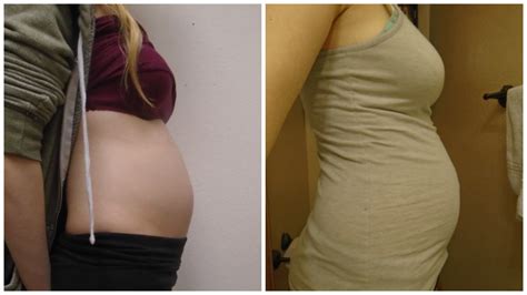 Baby Girl Vs Baby Boy Bumps Babycenter